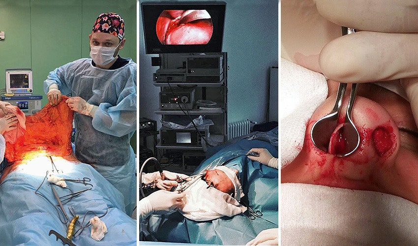 фото из операционных хирурга Эдуарда Шихирмана хирурга Георгия Чемянова и фото из аккаунта клиники «Время красоты»